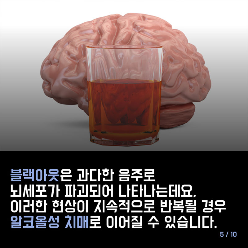 20, 30대의 내가 치매에 걸릴 수 있다? 사진 5번