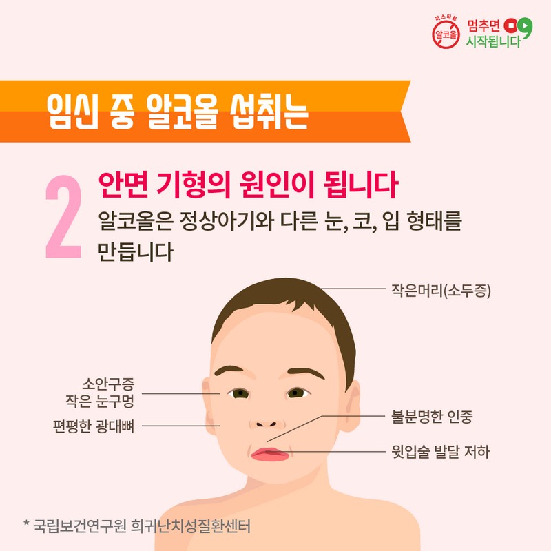 임산부 금주 사진 7번