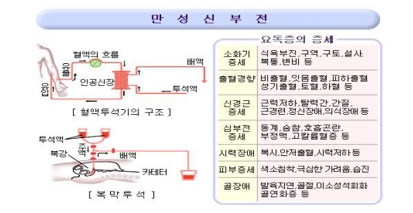 만성신부전