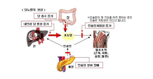 당뇨