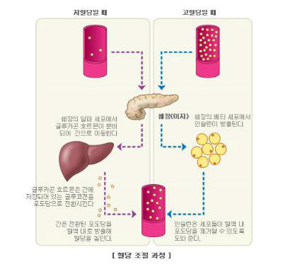 당뇨병성 케톤증