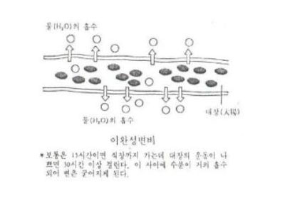 이완성 변비