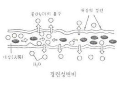 경련성 변비