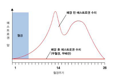 갱년기 증후군