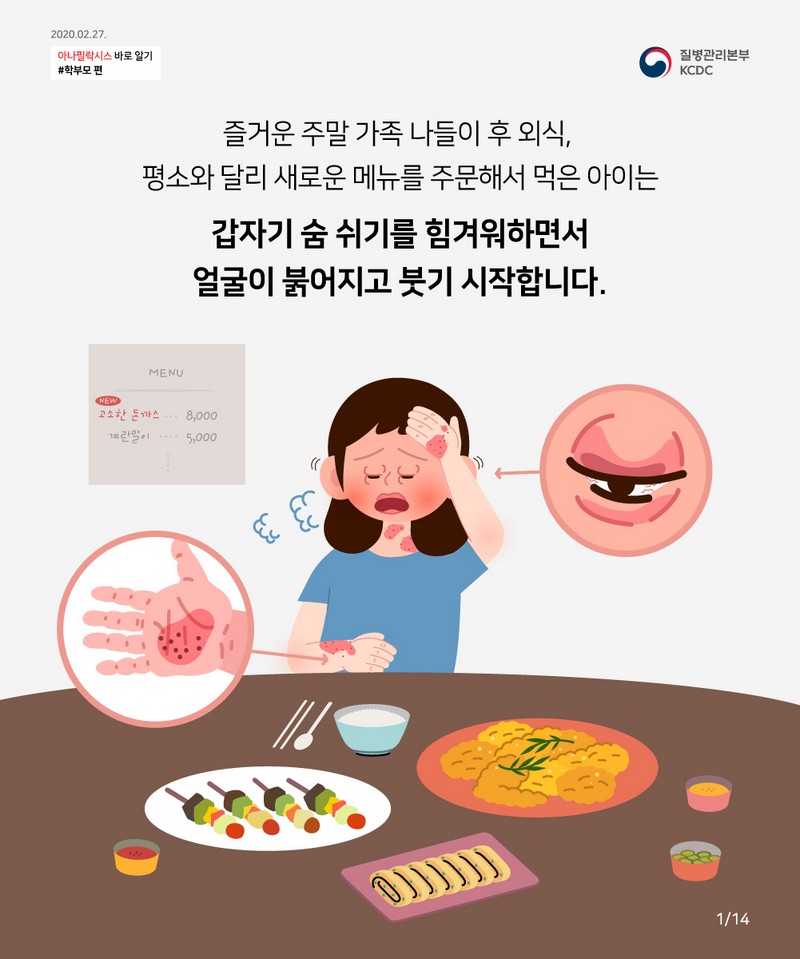 꼭 알아야 한다! 우리 아이 공격하는 아나필락시스 대처법 사진 2번