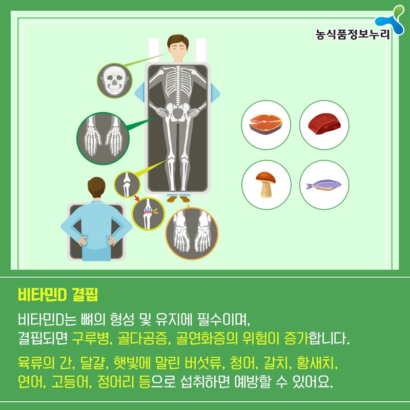 영양결핍, 식품으로 예방해요! 사진 7번