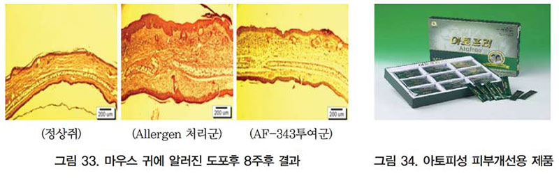 아토피성 피부개선용 제품