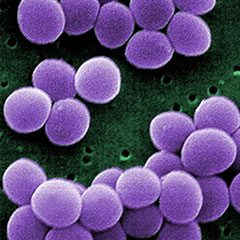 황색포도상구균 (Staphylococcus aureus)