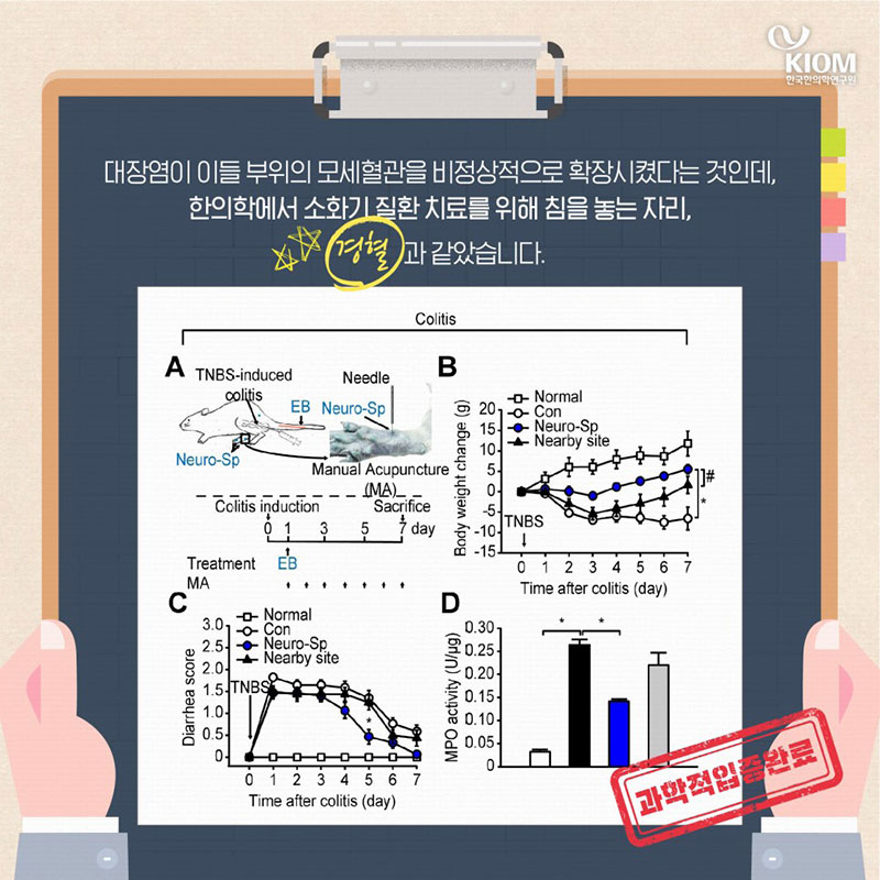 체했을 때 지압하면 낫는 이유? 기분 탓 아닌 혈자리 사진 7번