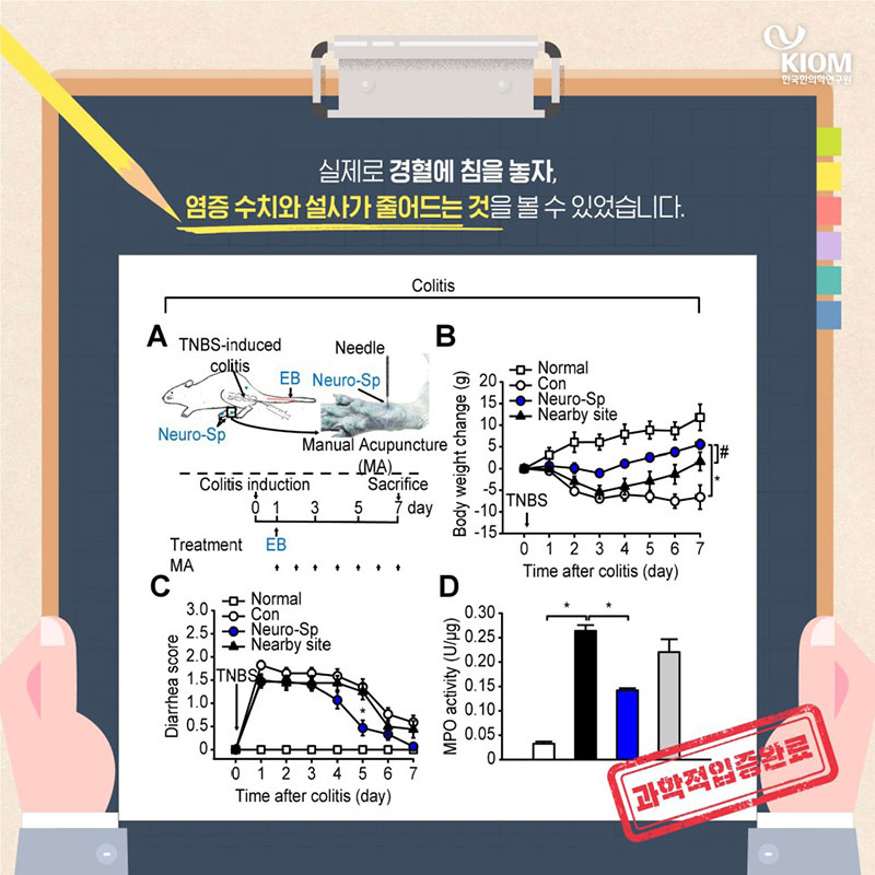 체했을 때 지압하면 낫는 이유? 기분 탓 아닌 혈자리 사진 9번