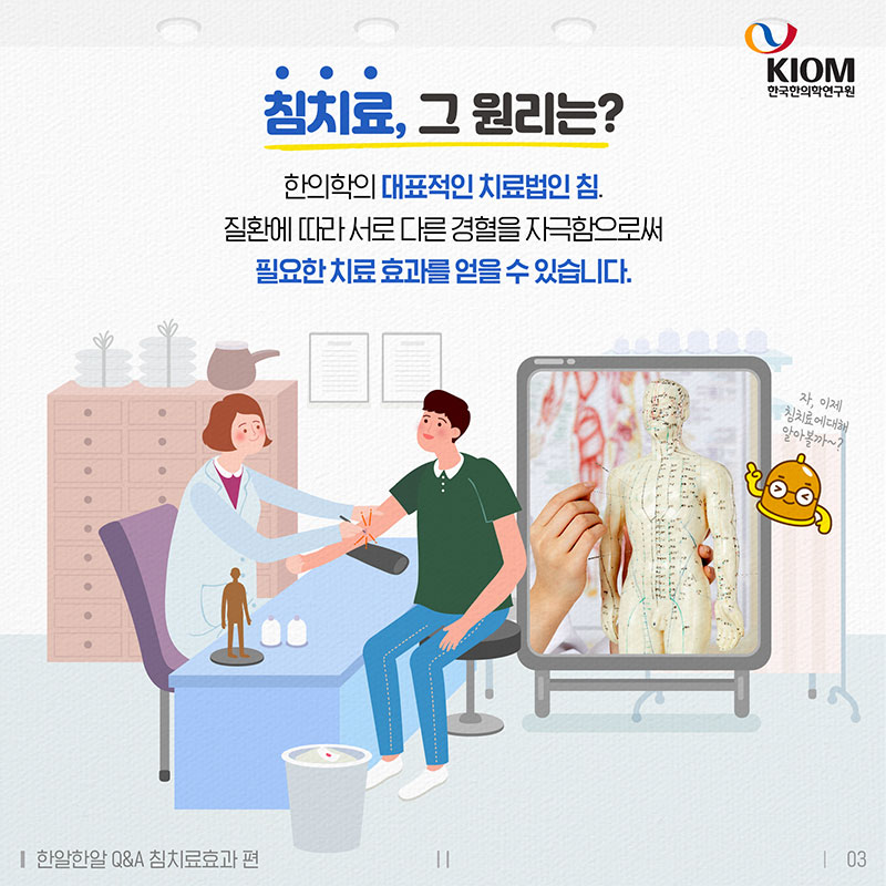 침 치료 효과, 과학적으로 증명할 수 있나요? 사진 3번