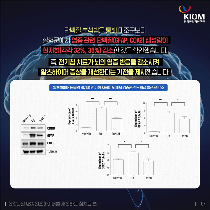 알츠하이머, 침치료로 개선될까요? 사진 7번