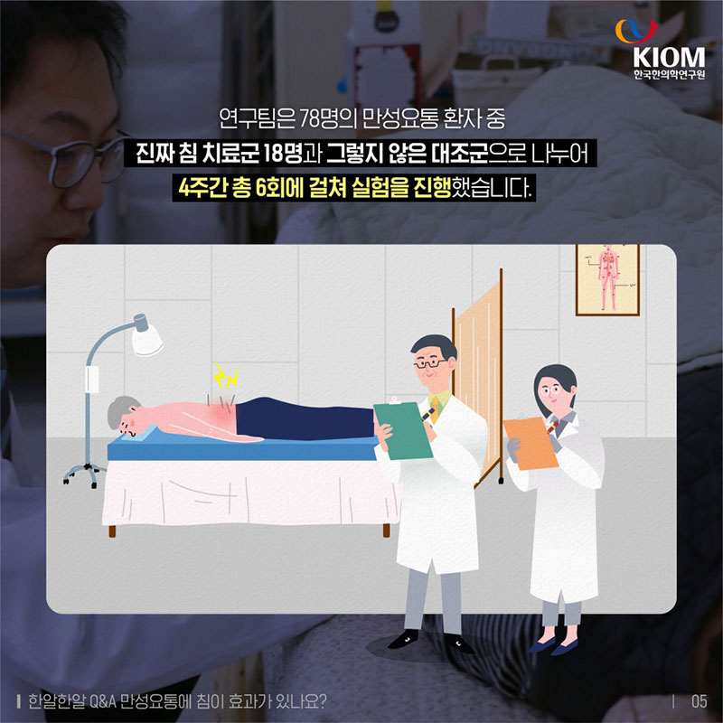만성요통에 침이 효과가 있나요? 사진 5번