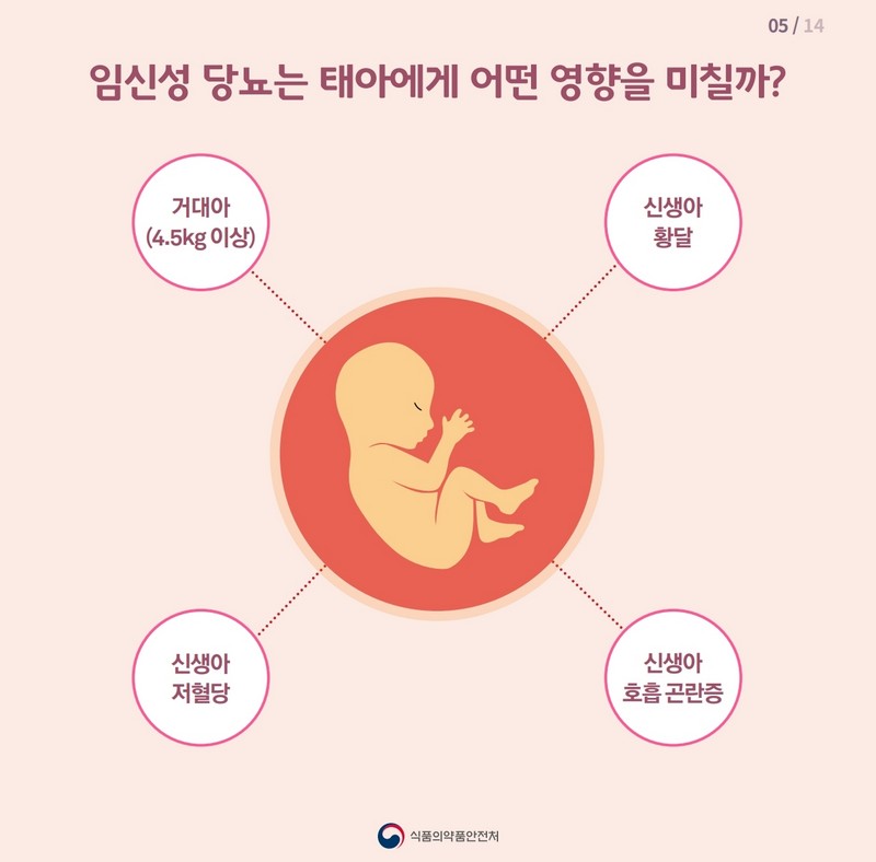 임신성 당뇨 이렇게 대처하세요 사진 6번