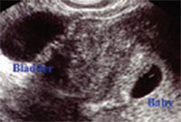 임신 1개월 (만 0~3주) 태아의 성장
