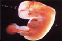 임신 2개월 (만 4~7주) 6주된 태아의 성장