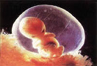 임신 2개월 (만 4~7주) 7주된 태아의 성장